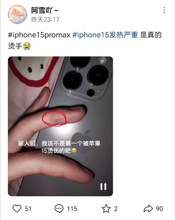 iPhone 15被投诉发热严重 苹果承认将软件修复：有人竟被烫伤 你怎么看？