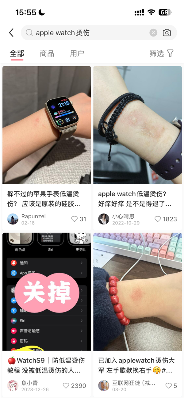 女子戴Apple Watch睡觉被烫伤起泡 苹果客服回应：过敏反应